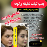 چسب لیفت دائم اورجینال فرانسوی