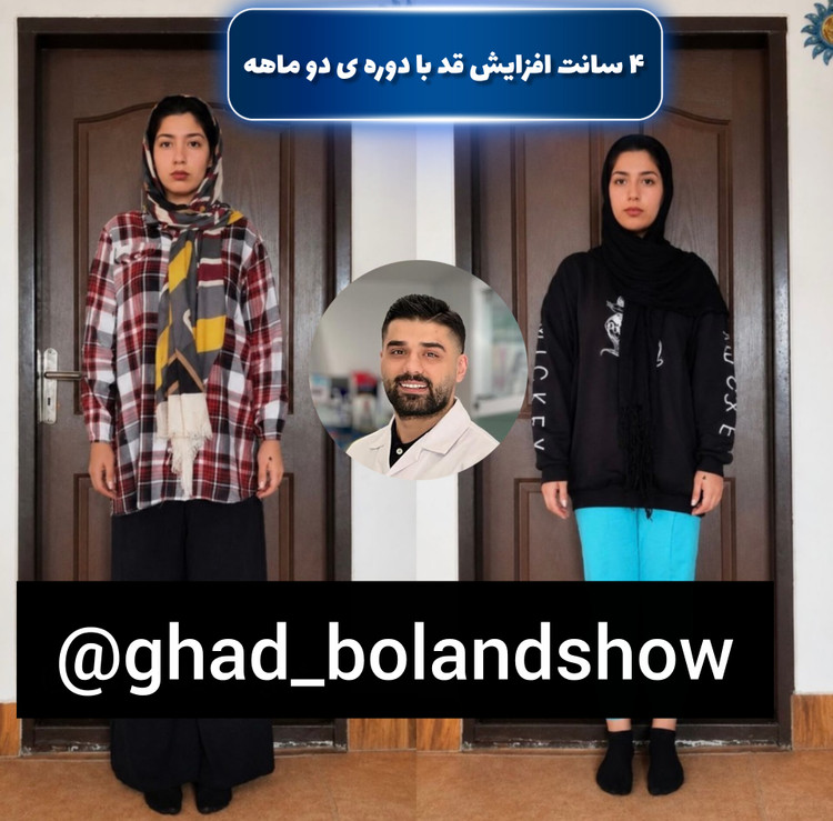 پکیج افزایش قد طبیعی تضمینی ۸ الی ۱۵ سانتی متر پکبج vipشامل ( مکمل های غضروف ساز + آیتم های ورزشی ویژه افرایش قد متناسب با bmi و آناتومی بدن شما + پشتیبانی کامل تا رسیدن به افزایش قد مد نظر )